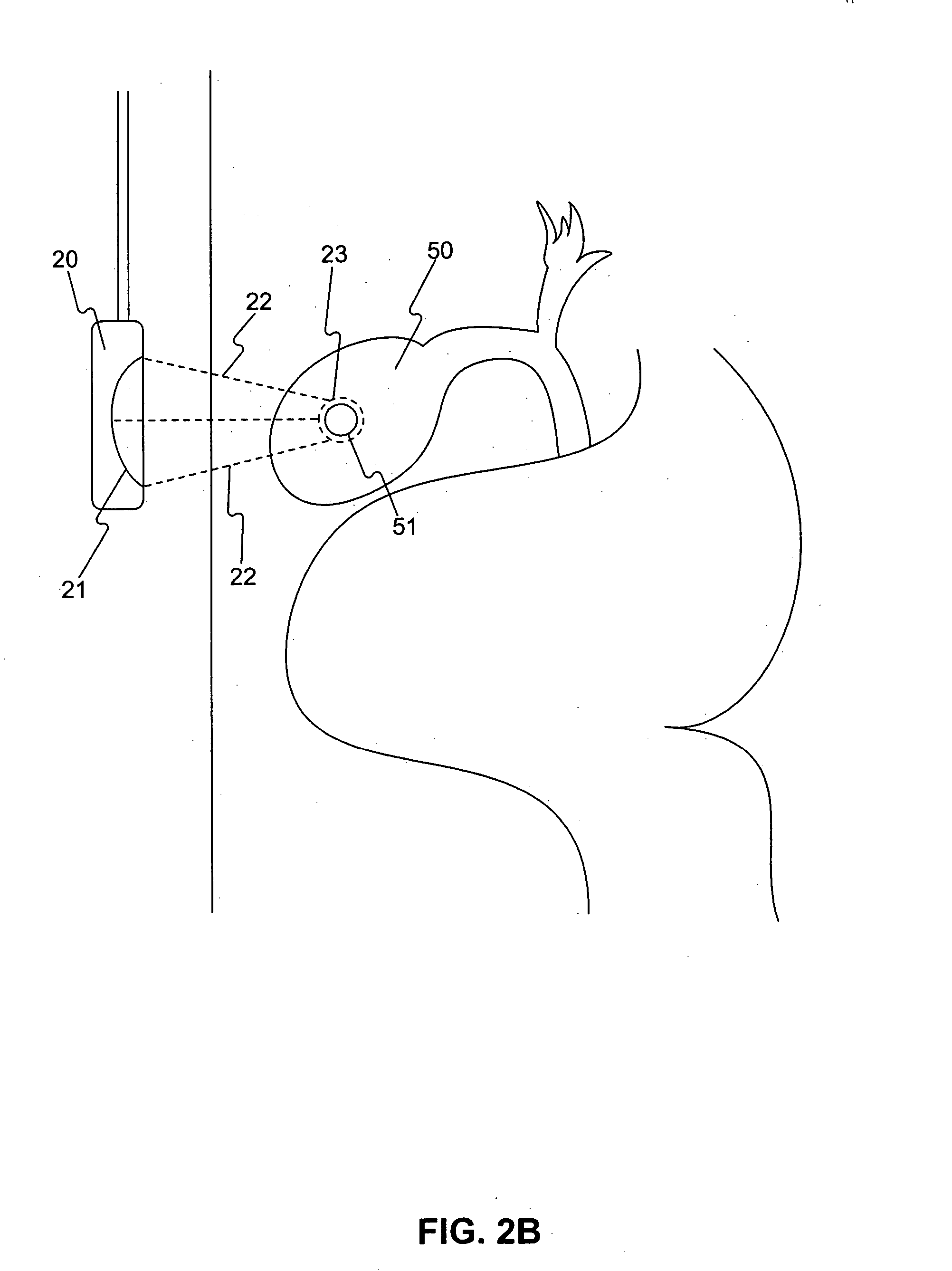 Methods of delivering energy to body portions to produce a therapeutic response