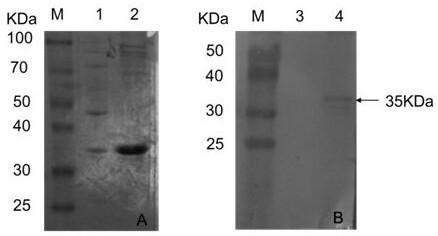 Hybridoma cell strain capable of secreting anti-rift valley fever virus NSs protein monoclonal antibody and application thereof