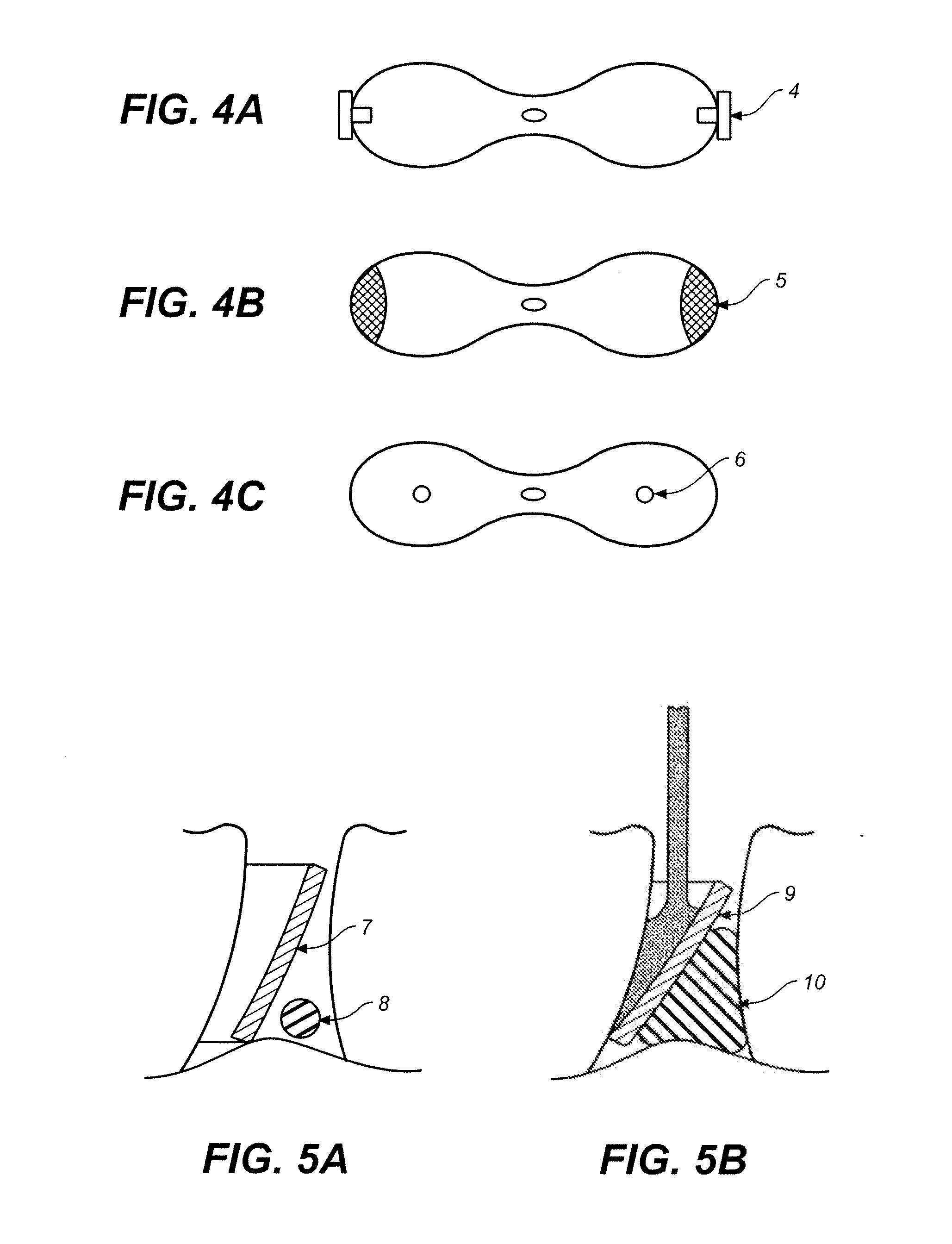 Elastic dental device