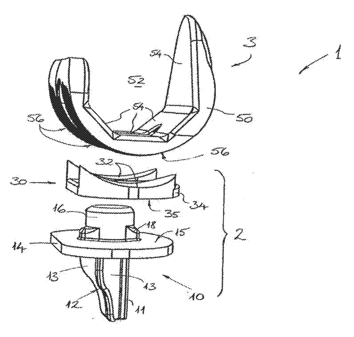 Knee Joint Prosthesis and Related Method