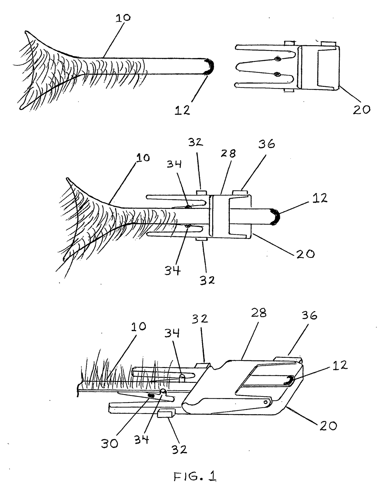 Electro-Mechanical Skin Pulling, Altering and Lifting Device with Optional Remote Control