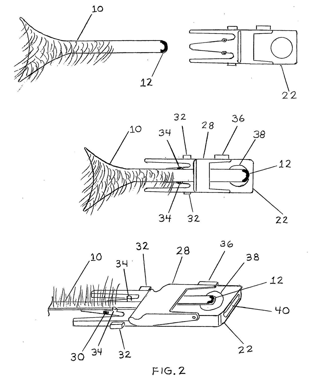 Electro-Mechanical Skin Pulling, Altering and Lifting Device with Optional Remote Control