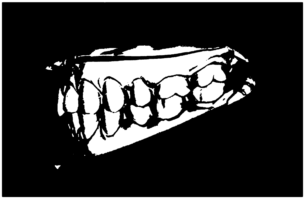 Orthodontic accessory planning method based on oral voxel model feature extraction