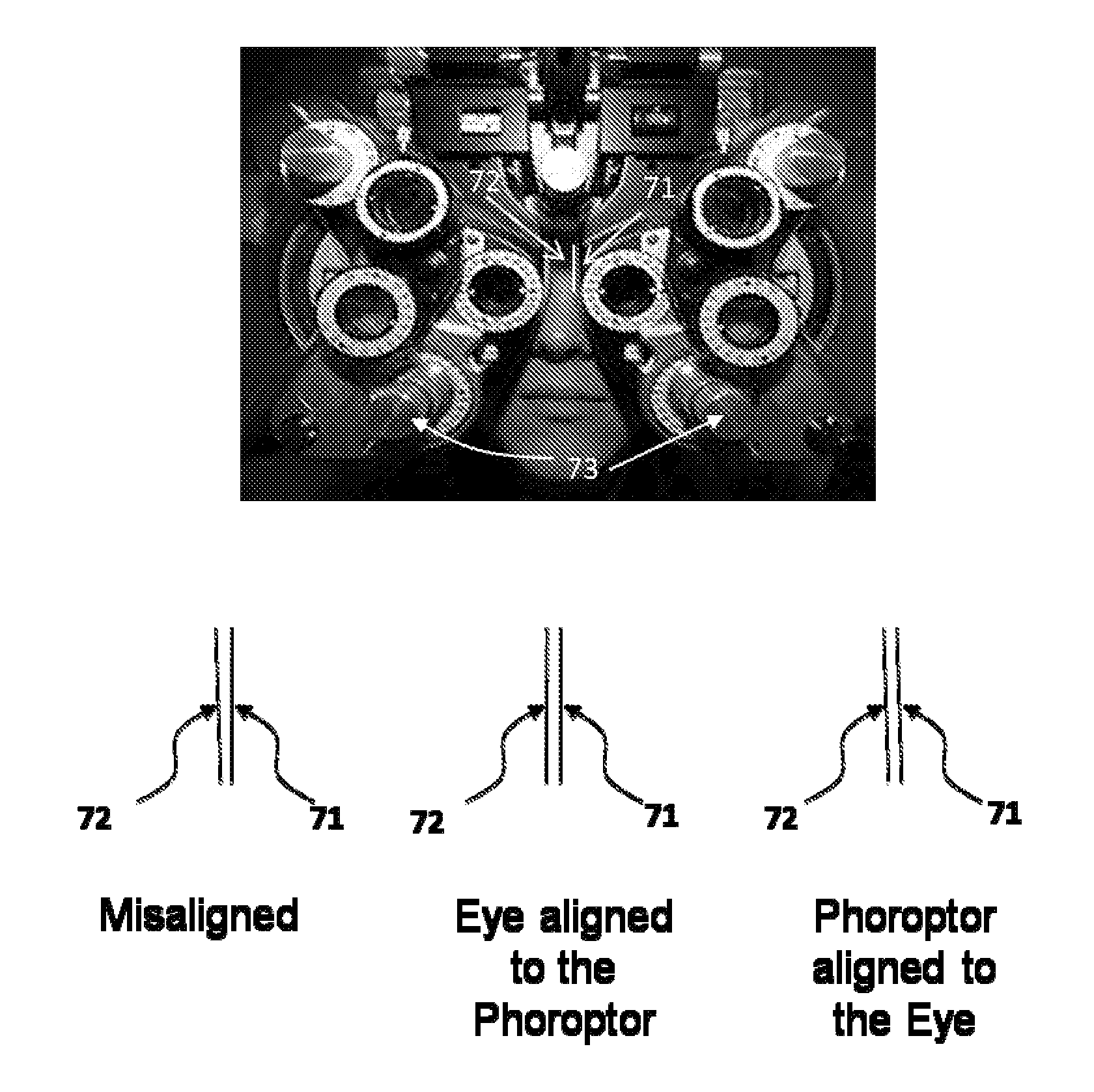 Methods and devices for refractive correction of eyes