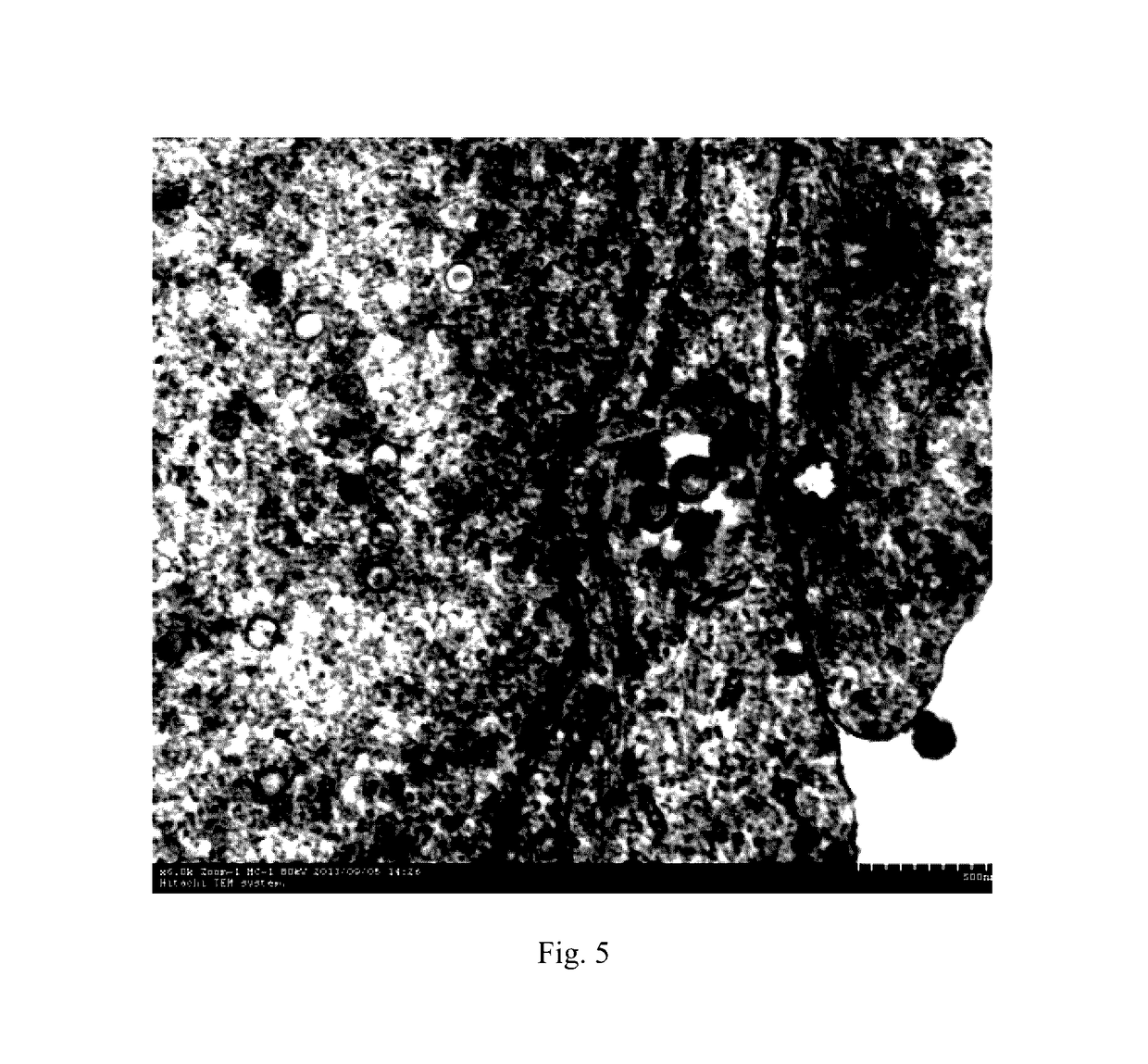 Cyprinid herpesvirus II-sensitive brain tissue cell line of <i>Carassius auratus gibelio </i>and establishing method and use thereof