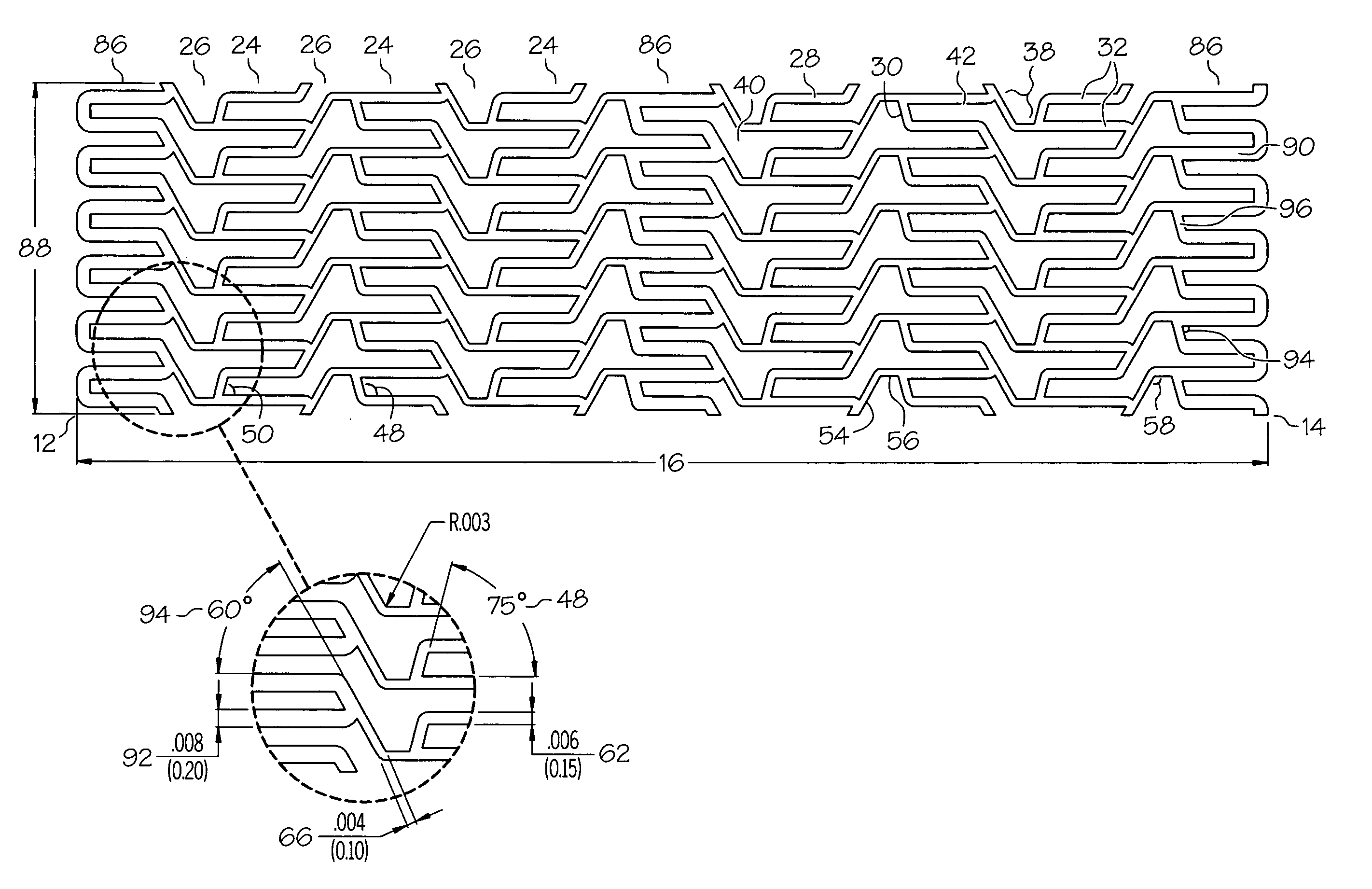 Intravascular Stent