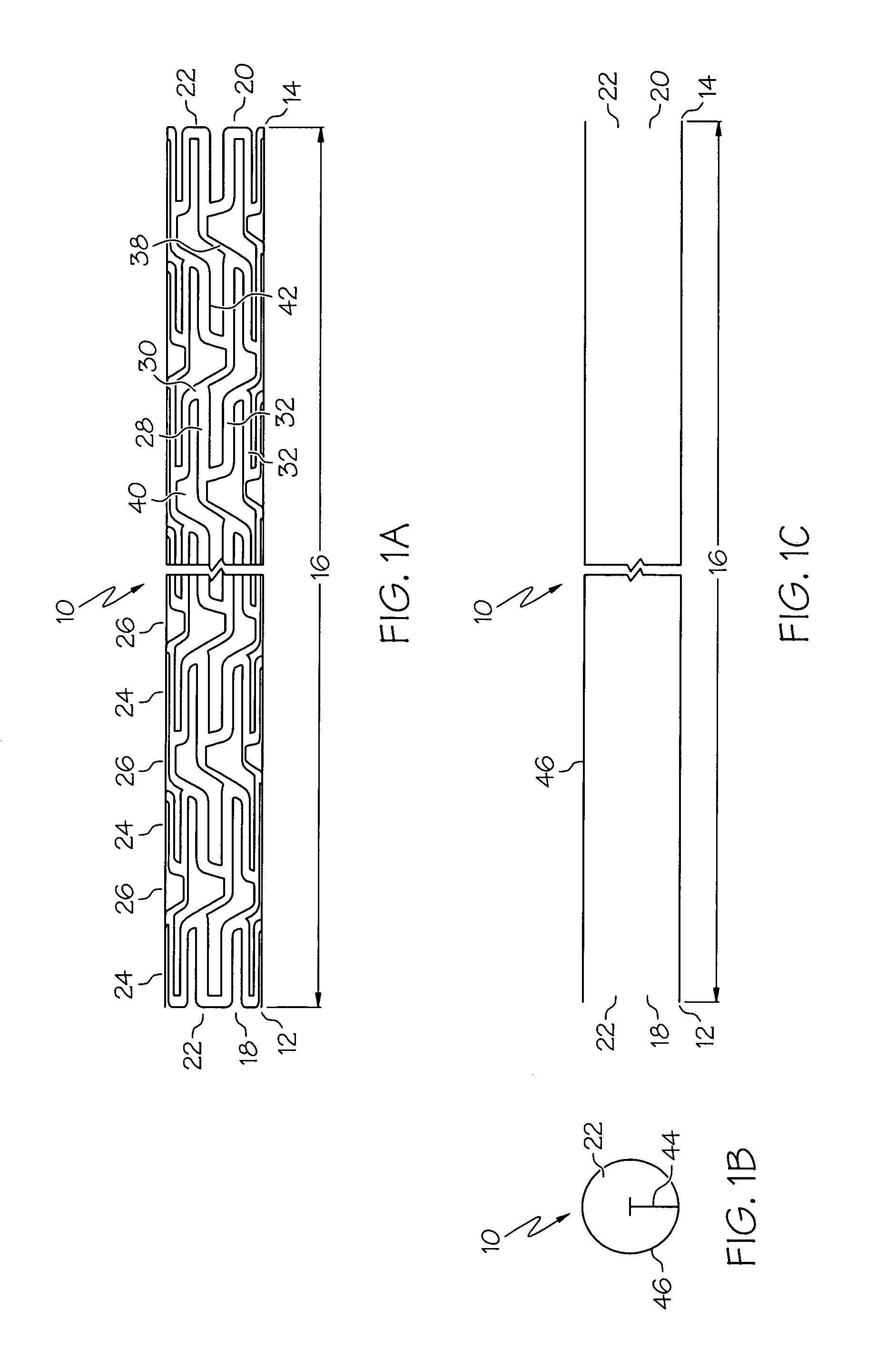 Intravascular Stent