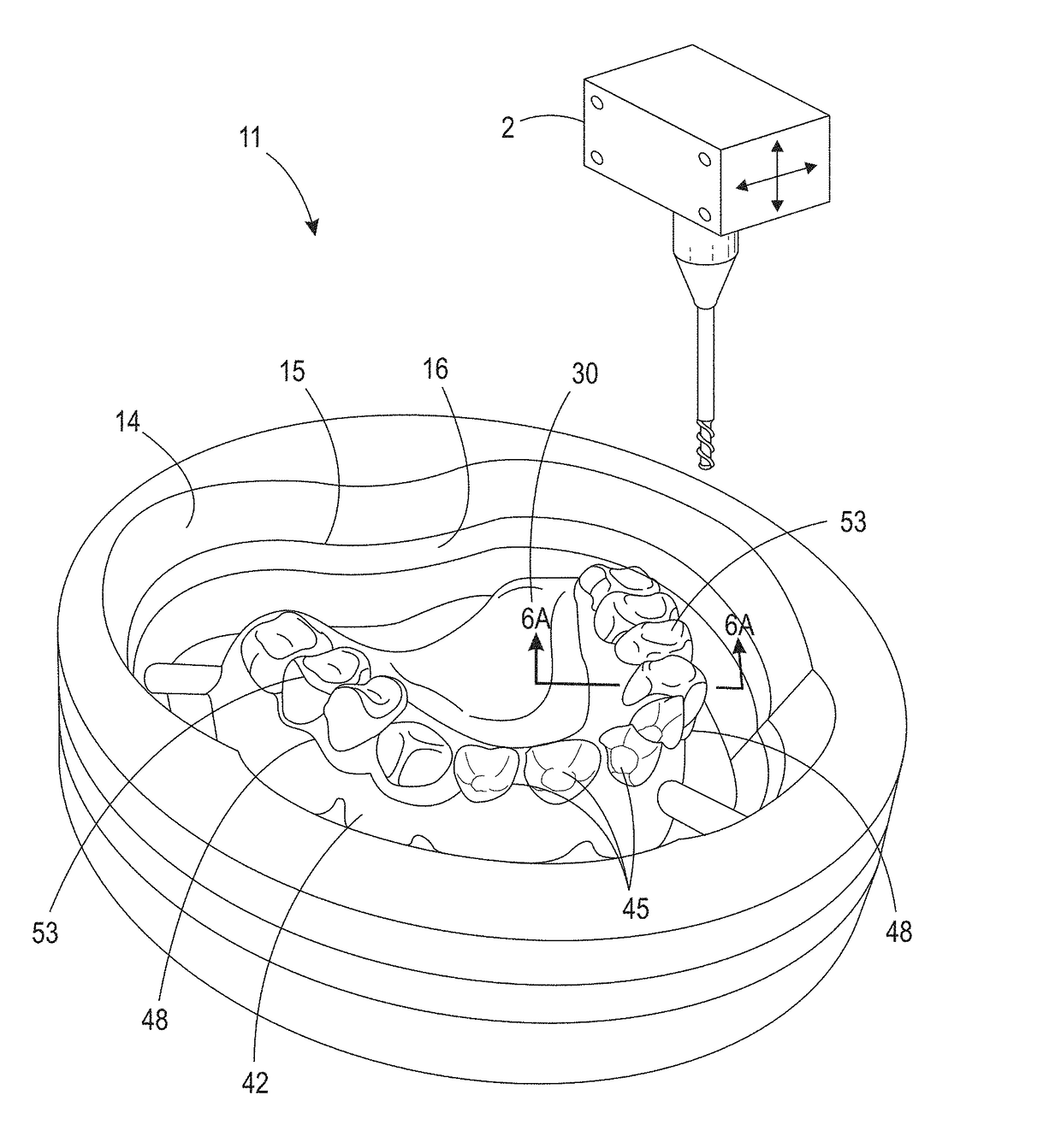 Formed denture and method of making same