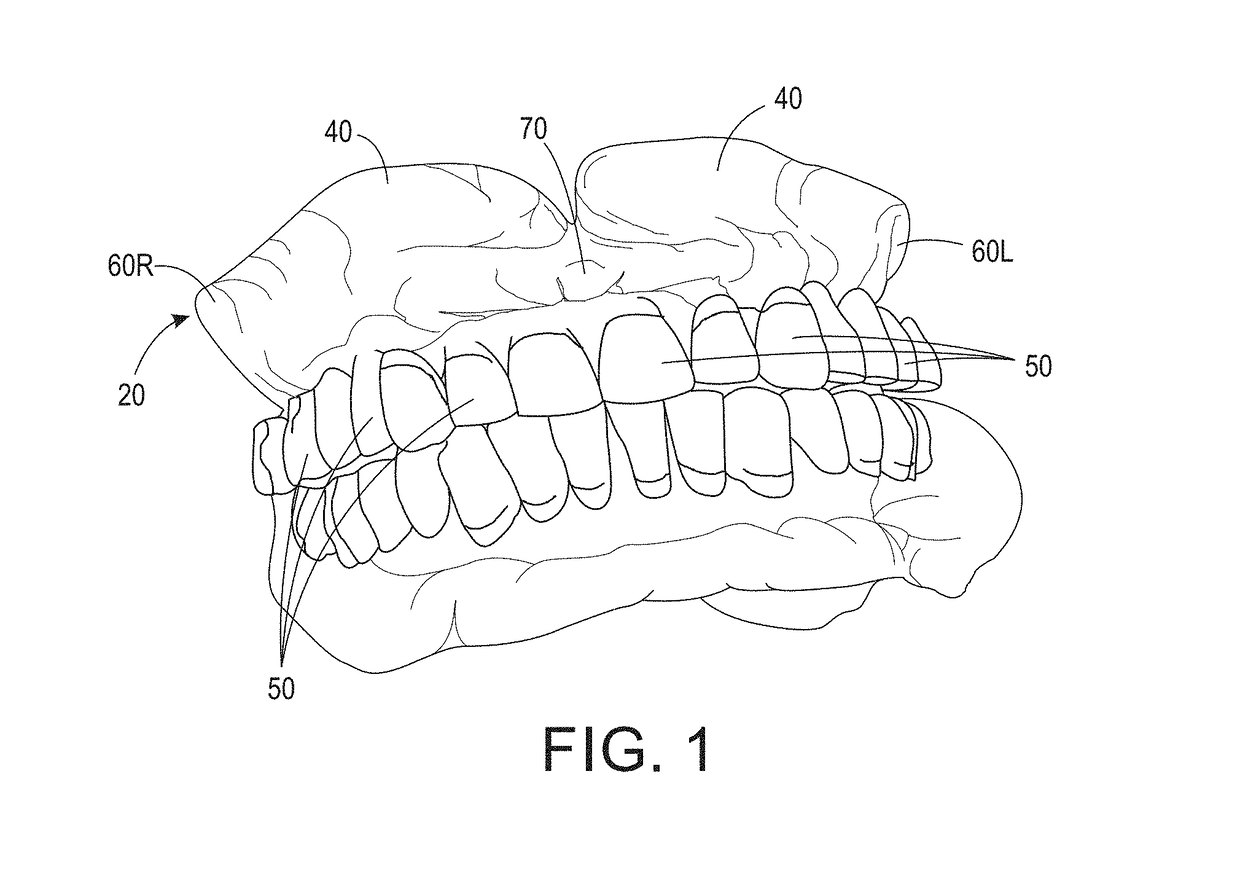 Formed denture and method of making same