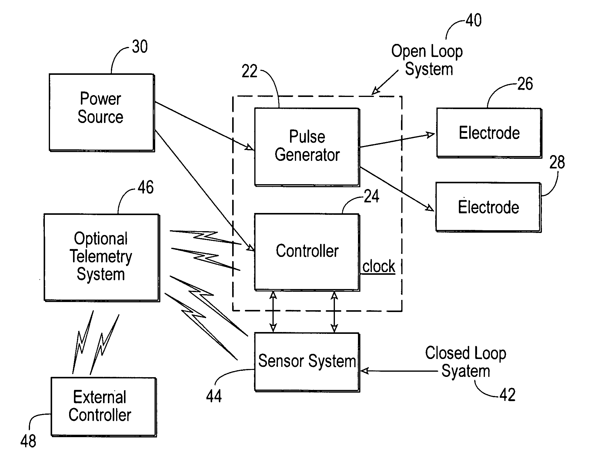 Method of using a gastrointestinal stimulator device for digestive and eating disorders