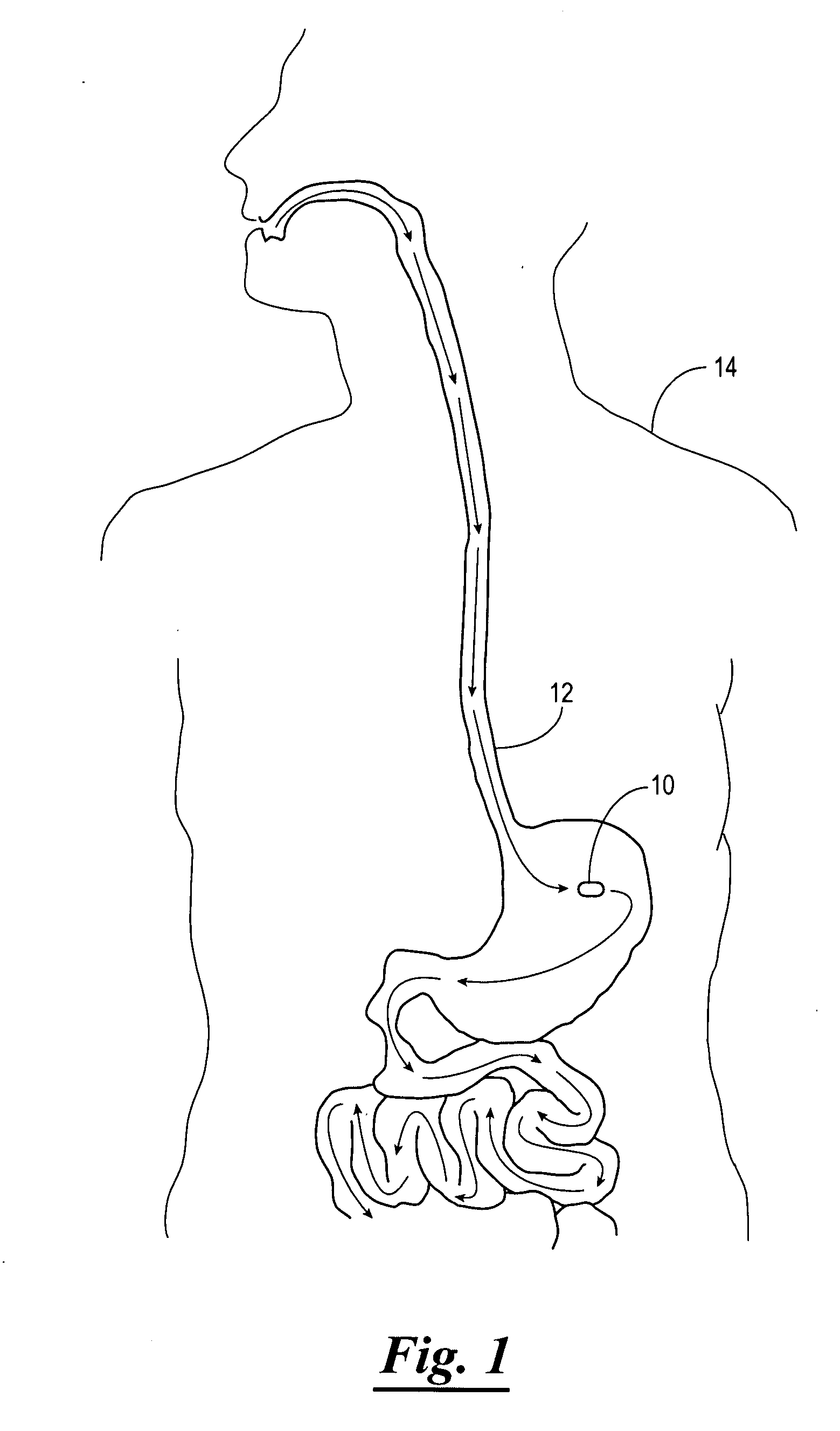 Method of using a gastrointestinal stimulator device for digestive and eating disorders