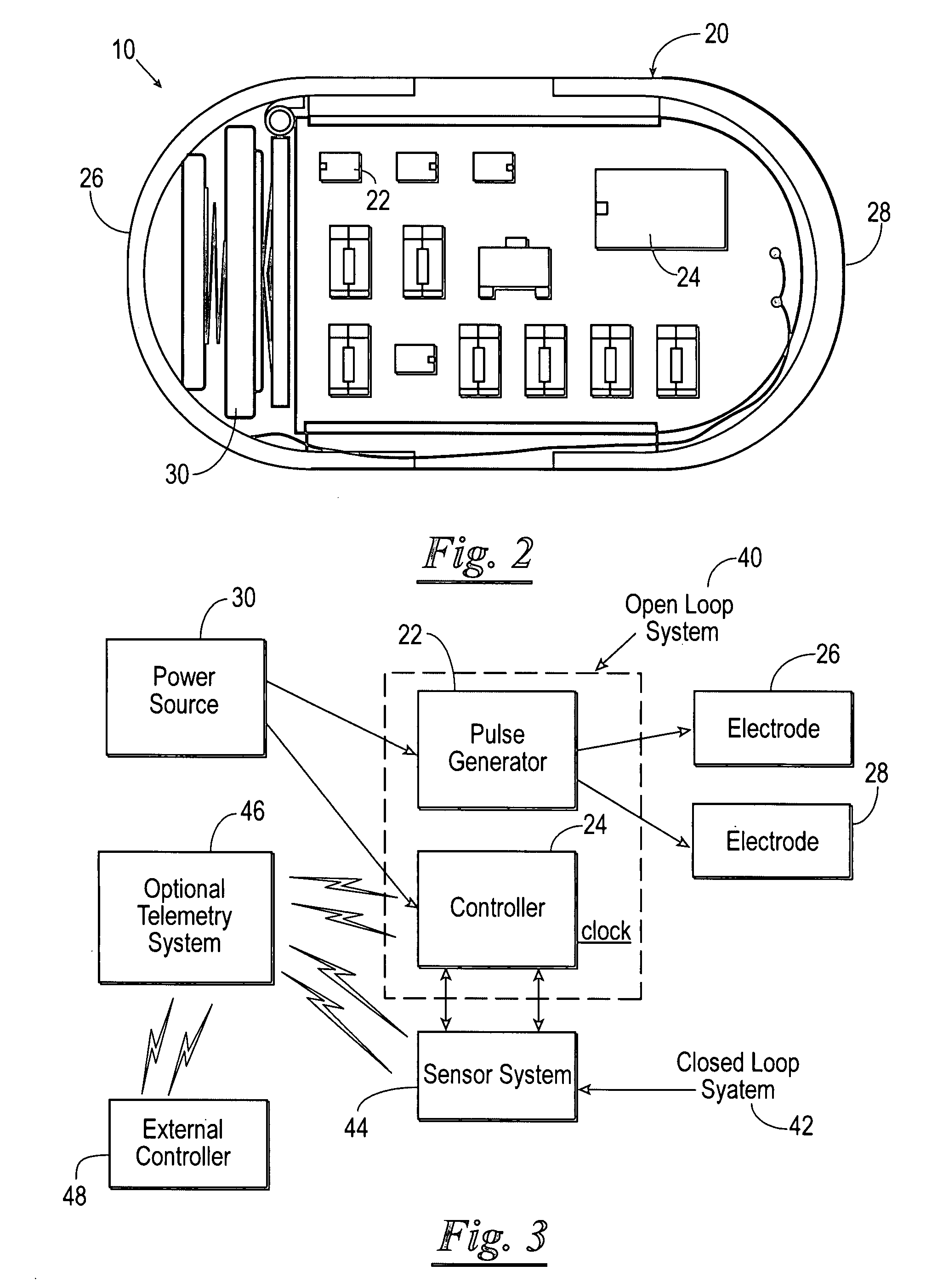 Method of using a gastrointestinal stimulator device for digestive and eating disorders