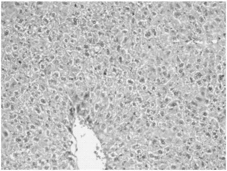 Application of tripterine in preparation of medicines for treating cholestatic liver disease