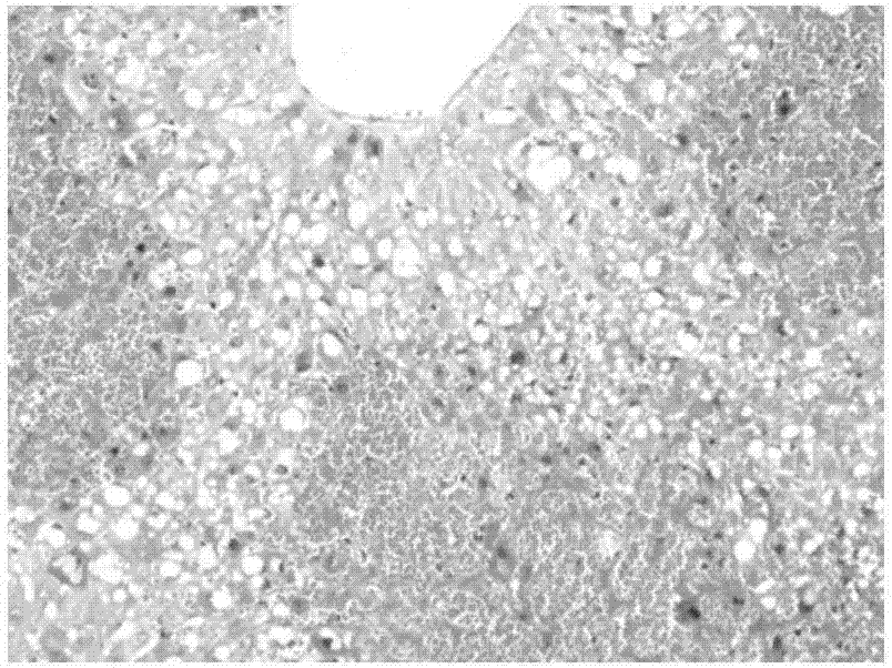 Application of tripterine in preparation of medicines for treating cholestatic liver disease