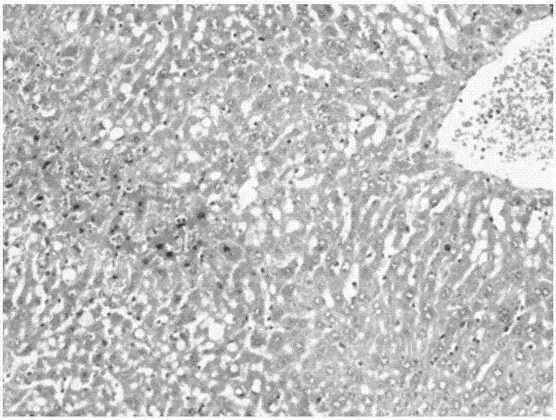 Application of tripterine in preparation of medicines for treating cholestatic liver disease