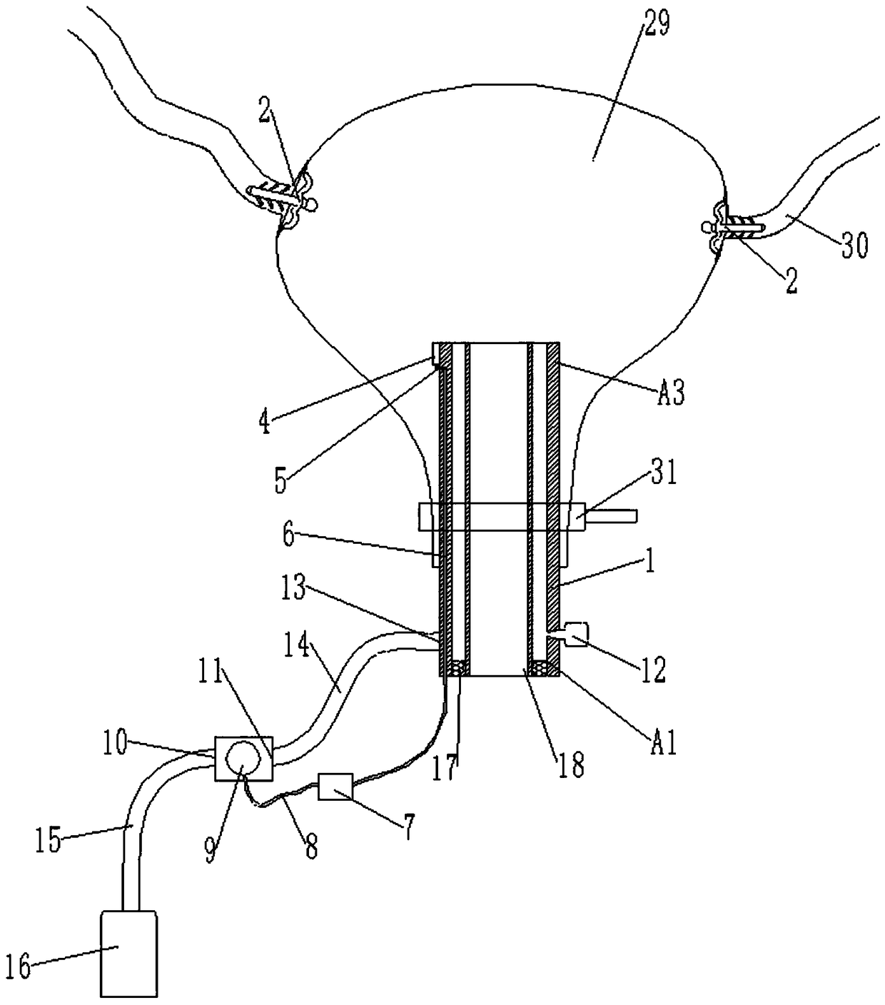 Closed constant pressure controlled hysteroscopic surgery waterproof poisoning auxiliary device