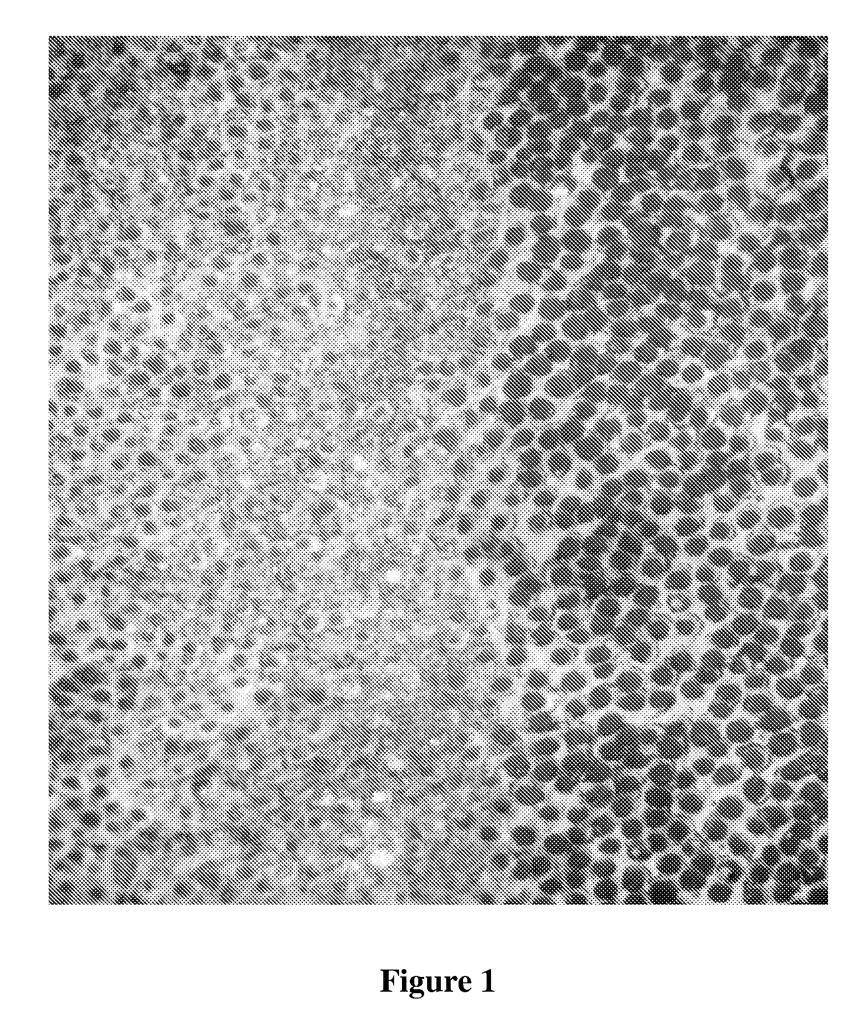 Agent for protection of tooth surfaces, in conjunction with conventional bleaching methods, by biomimetic deposition of fluorapatite