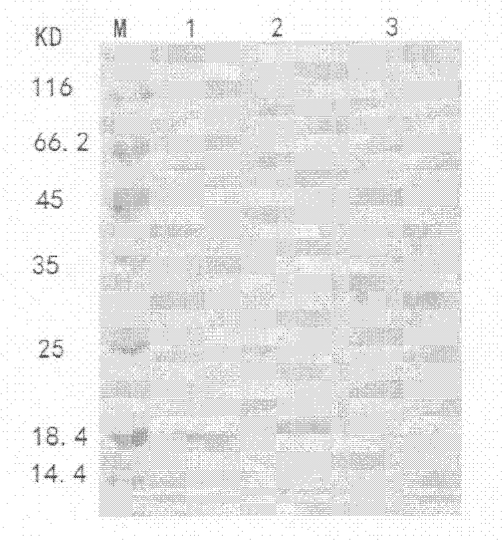 Small molecular superantigen modified protein, its encoding gene, preparation process and application thereof