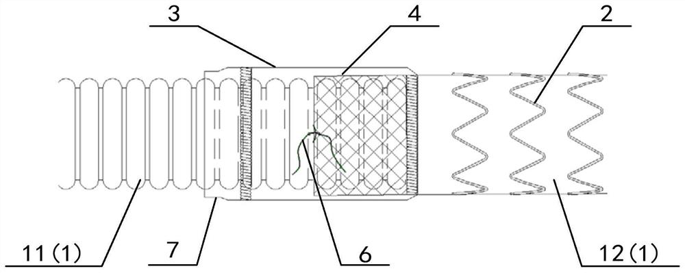 Suture-free stent graft