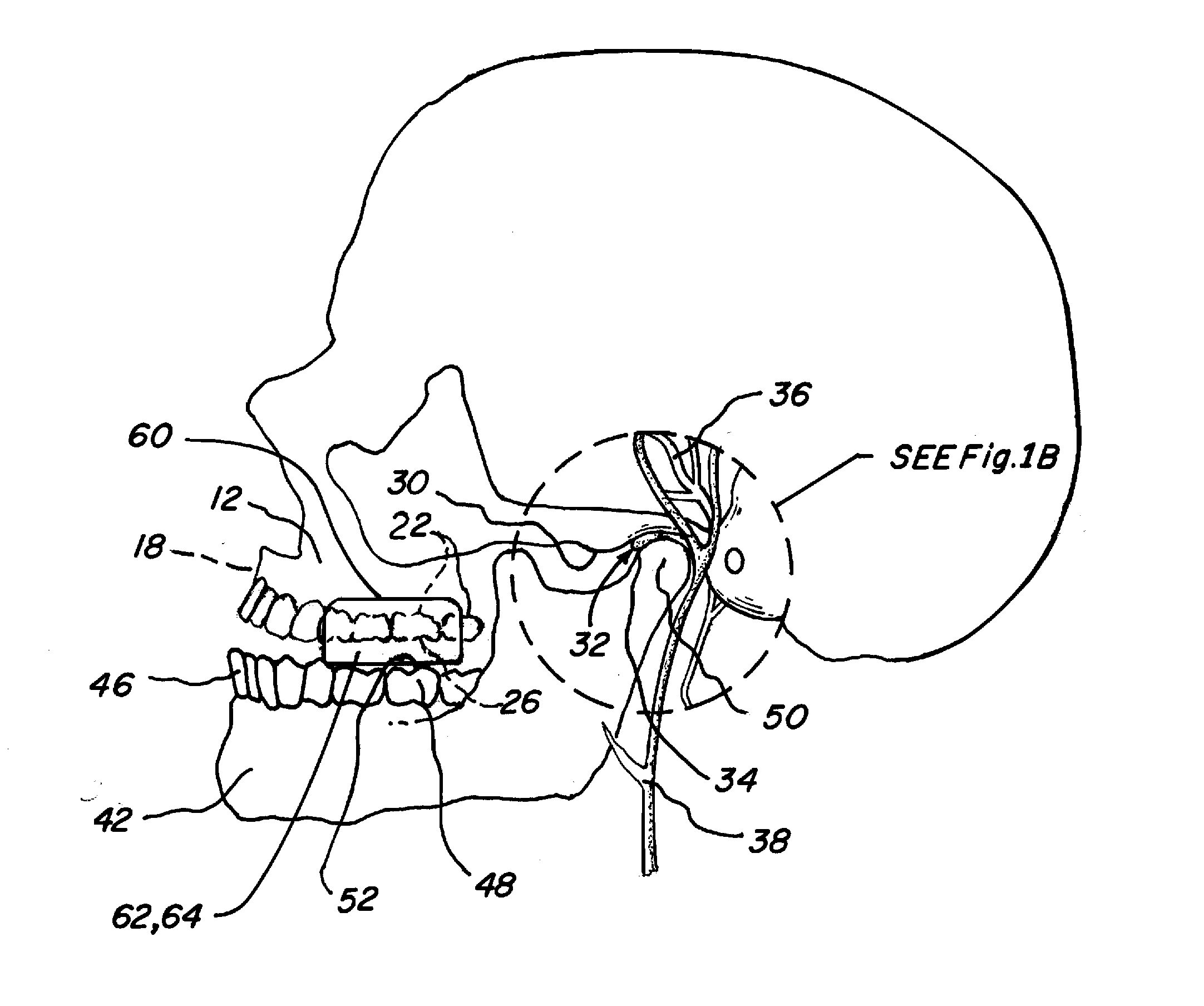 Methods and Apparatus for Reduction of Cortisol