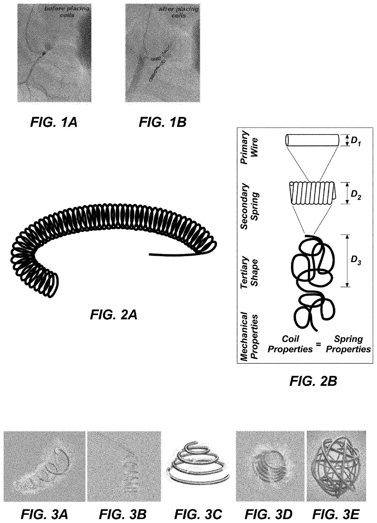 Occlusive device with self-expanding struts