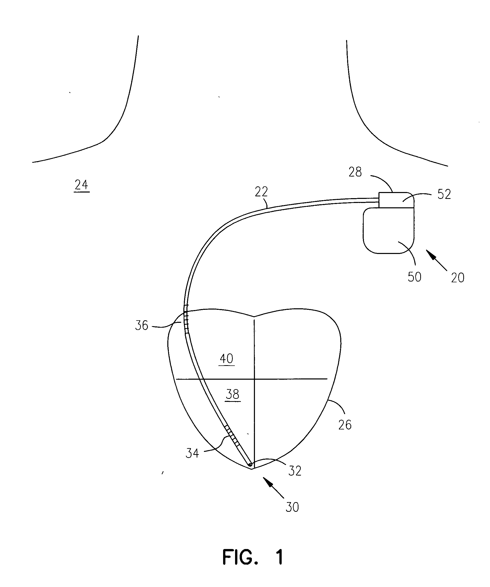 Method and system for identifying and displaying groups of cardiac arrhythmic episodes