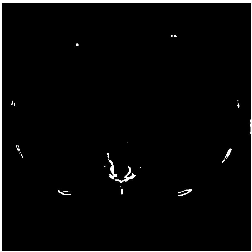 Deep learning method-based automatic pulmonary nodule detection method