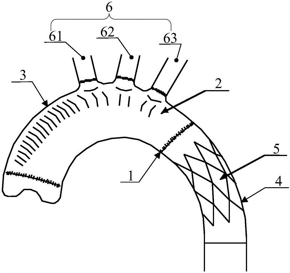 Intraoperative support conveying system and intraoperative support system