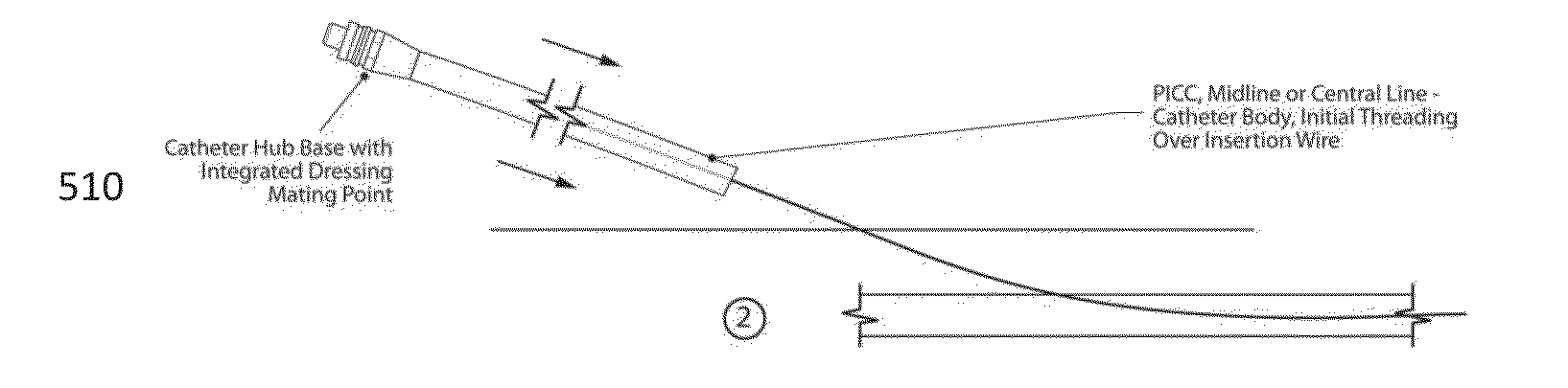 Two-Part Multi-Function Vascular Catheter And Integrated Circumferentially Sealing Securement Dressing