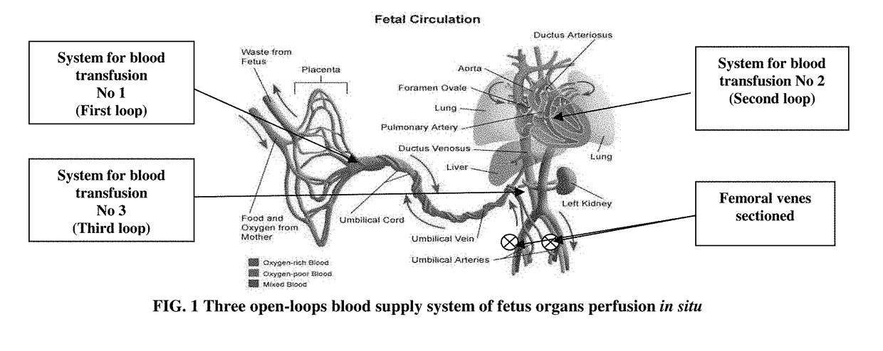 Method of Progenitor Cell Isolation From Different Organs by Natural Destruction of Extracellular Matrix