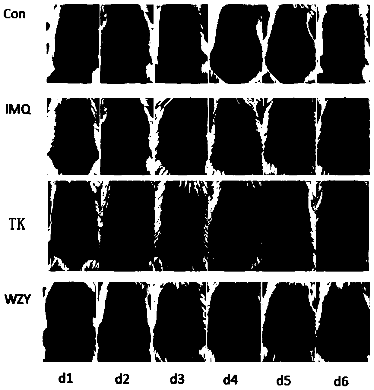 Application of rutaecarpine to preparation of medicine for treating psoriasis