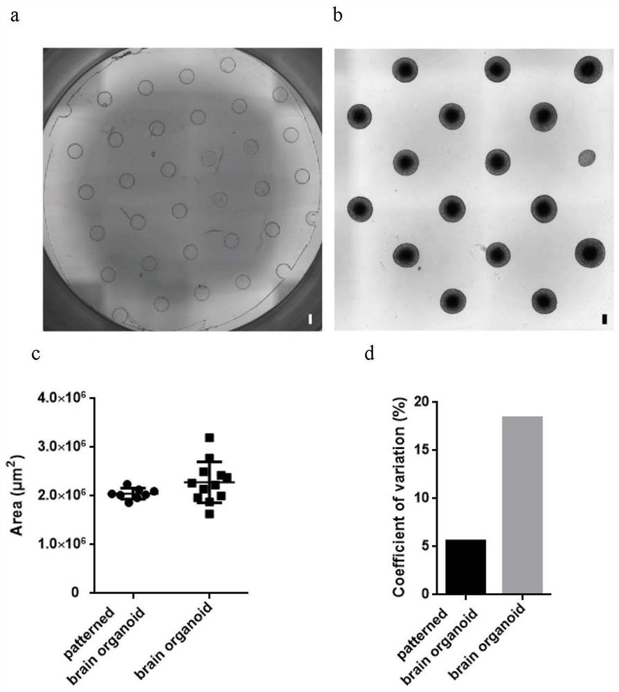 Brain organoid model and preparation method and application thereof