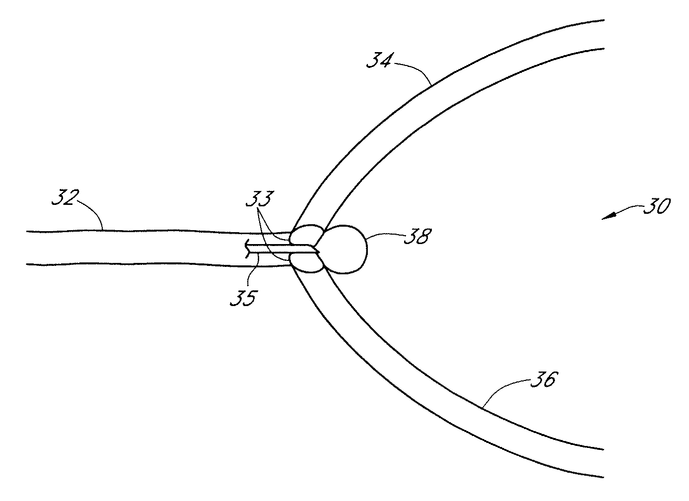 Methods of treating a blood vessel