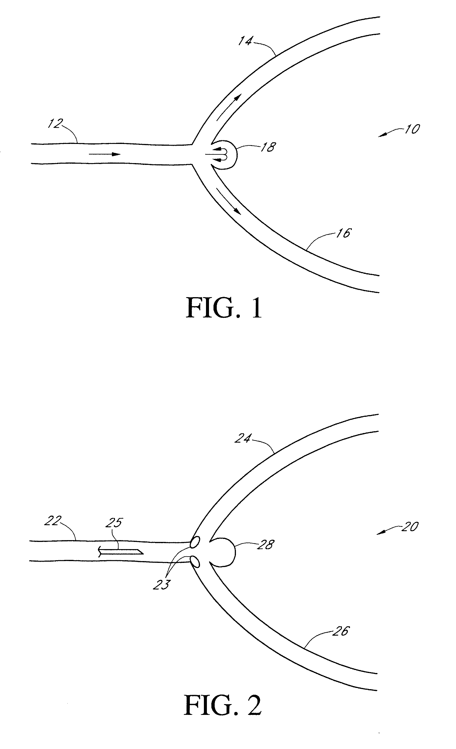 Methods of treating a blood vessel