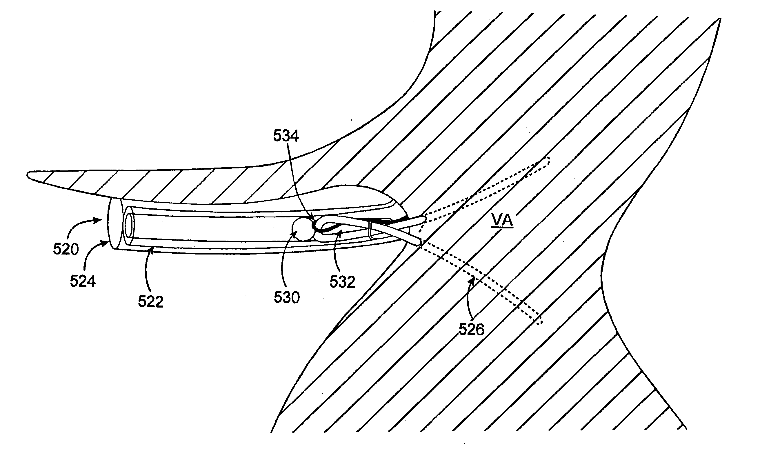 Delivery devices and methods for heart valve repair