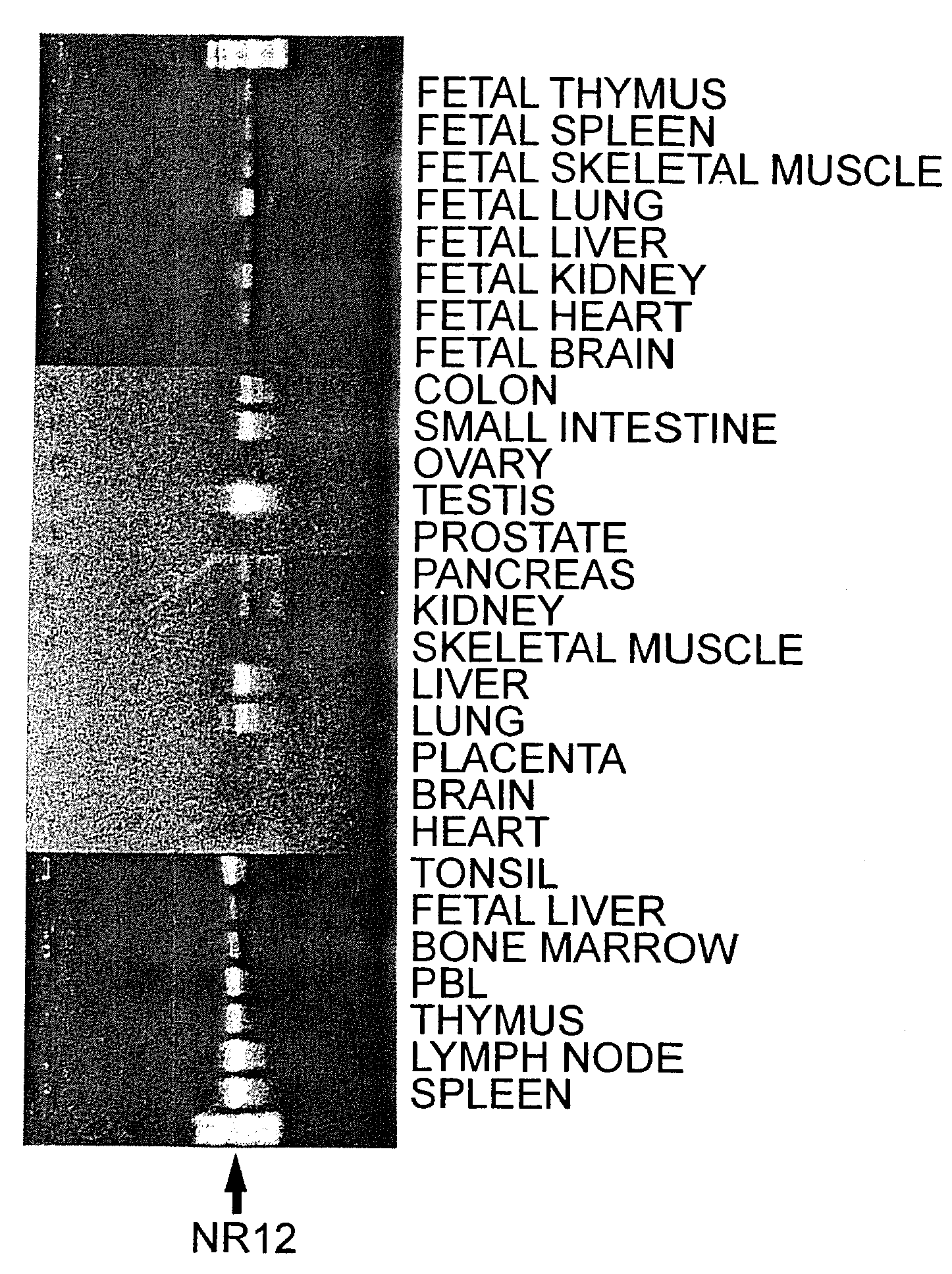 Novel hemopoietin receptor protein, nr12