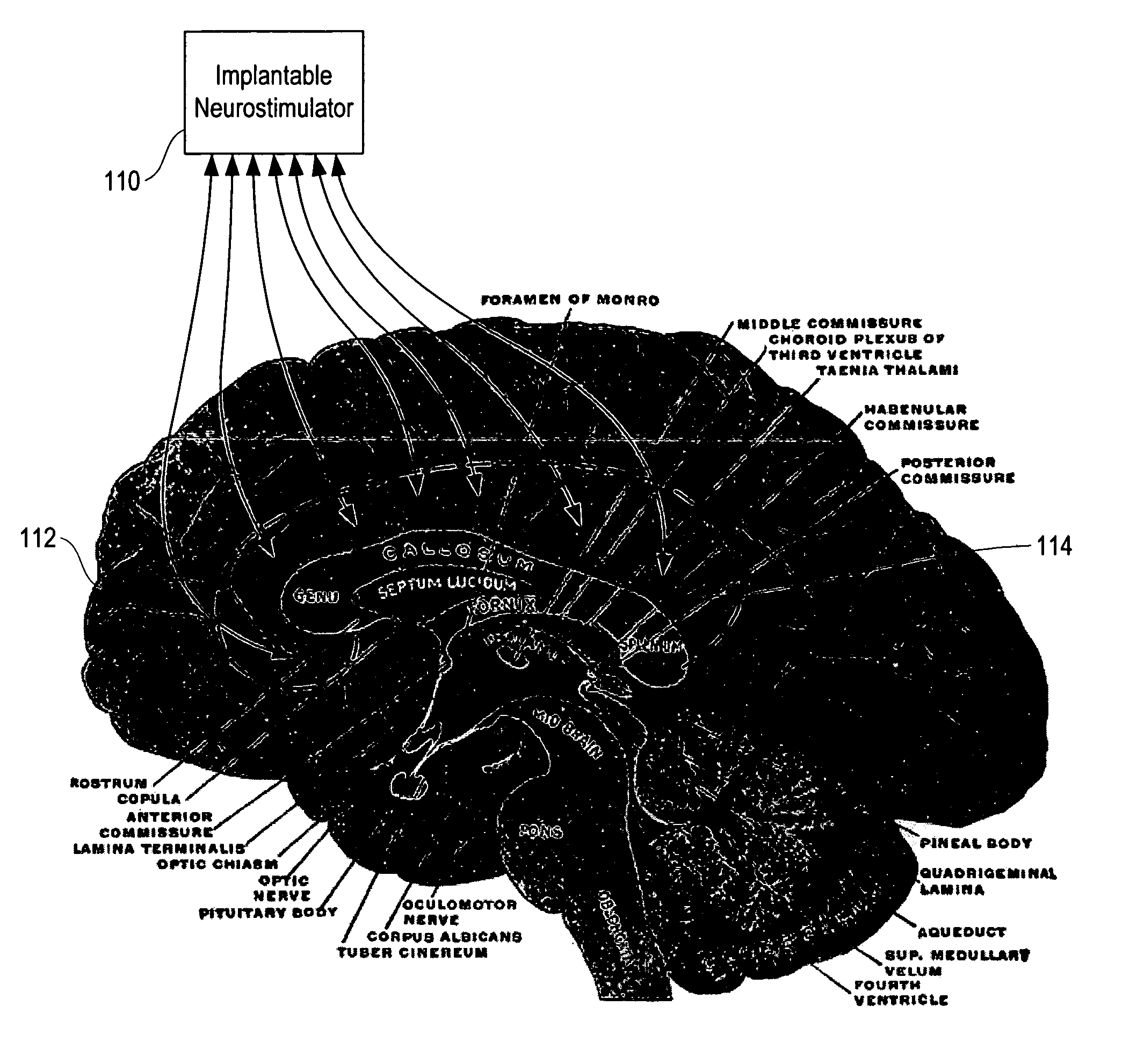 Responsive therapy for psychiatric disorders