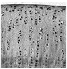 Bionic multi-scale structural surface with excellent tribological performance and preparation method