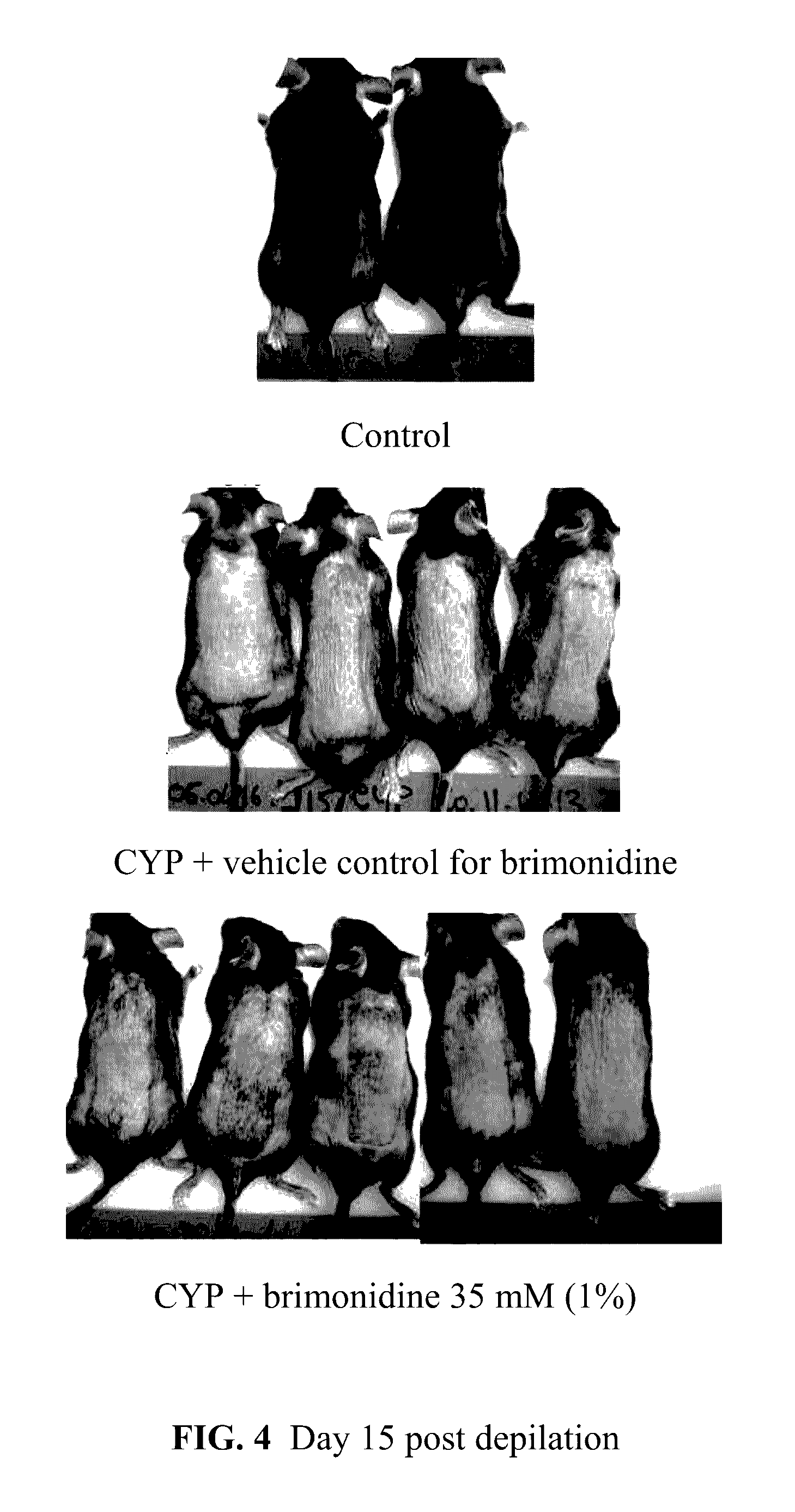 Method of reducing hair loss associated with chemotherapy