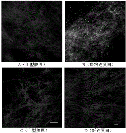 Calcium carbonate microsphere-extracellular matrix composite material as well as preparation method and application thereof