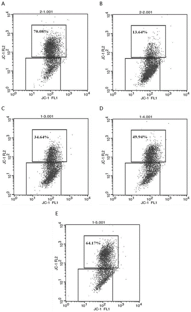 Traditional Chinese medicine composition and preparation method and application thereof