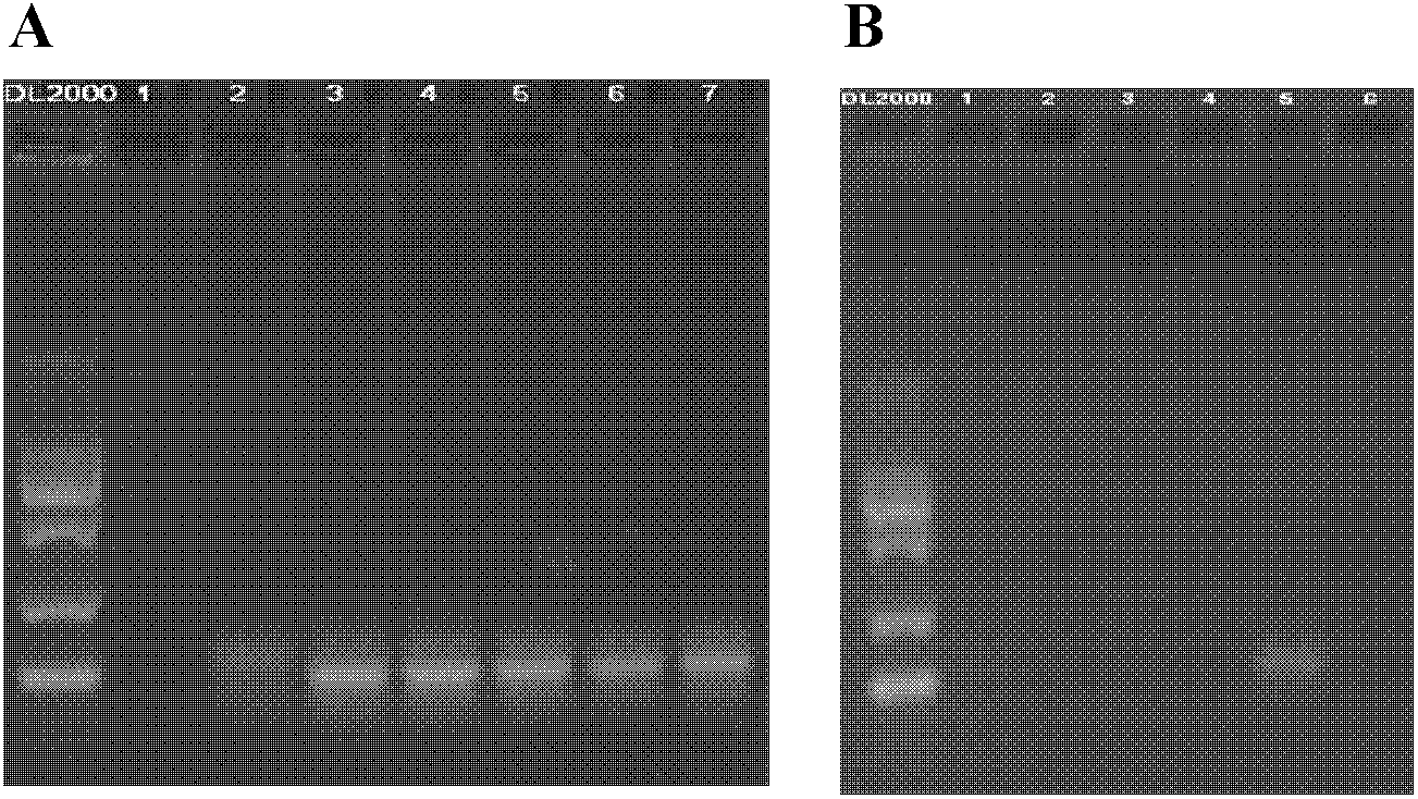 Chemiluminescence detection method for copy number polymorphism based on magnetic separation and primer extension