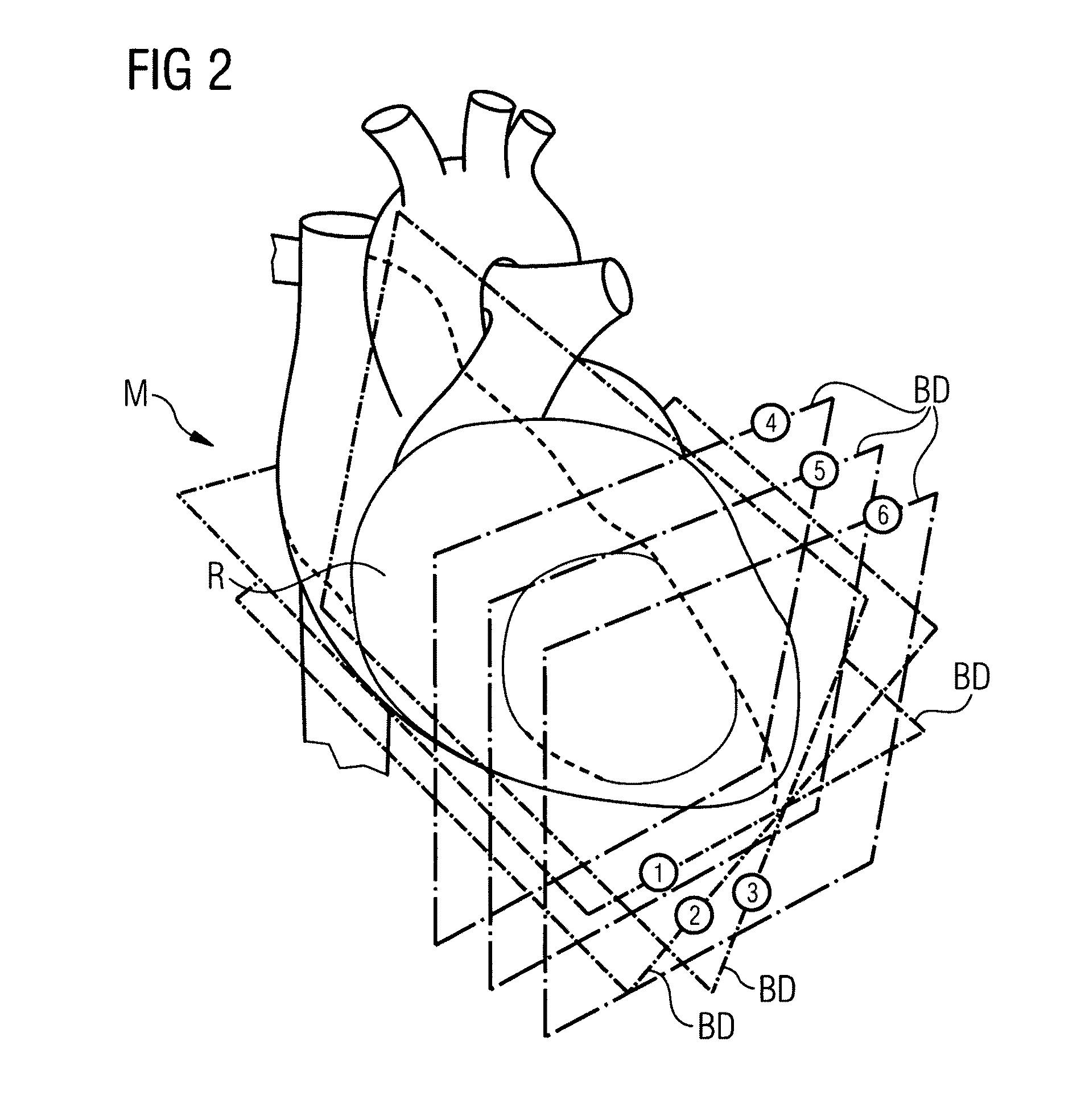 Model generator for cardiological diseases