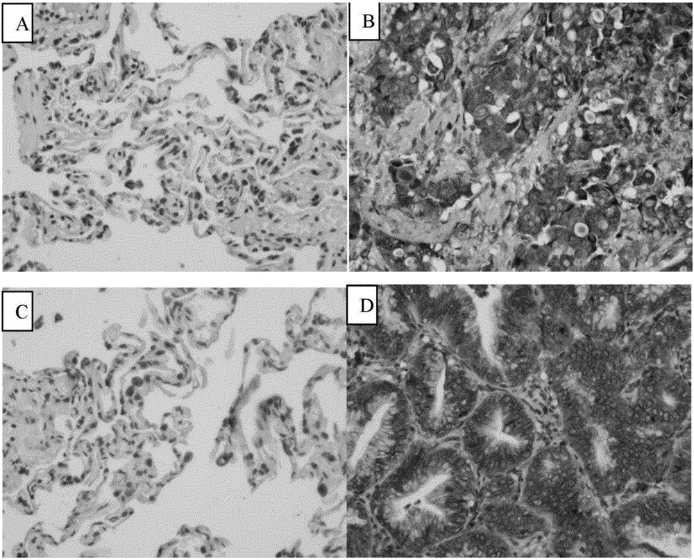 Application of TRIM66 protein in preparing non-small cell lung cancer prognosis evaluation reagent or kit