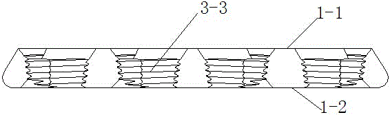 Spiral pressurization lock-in synchronism bone plate and application method thereof