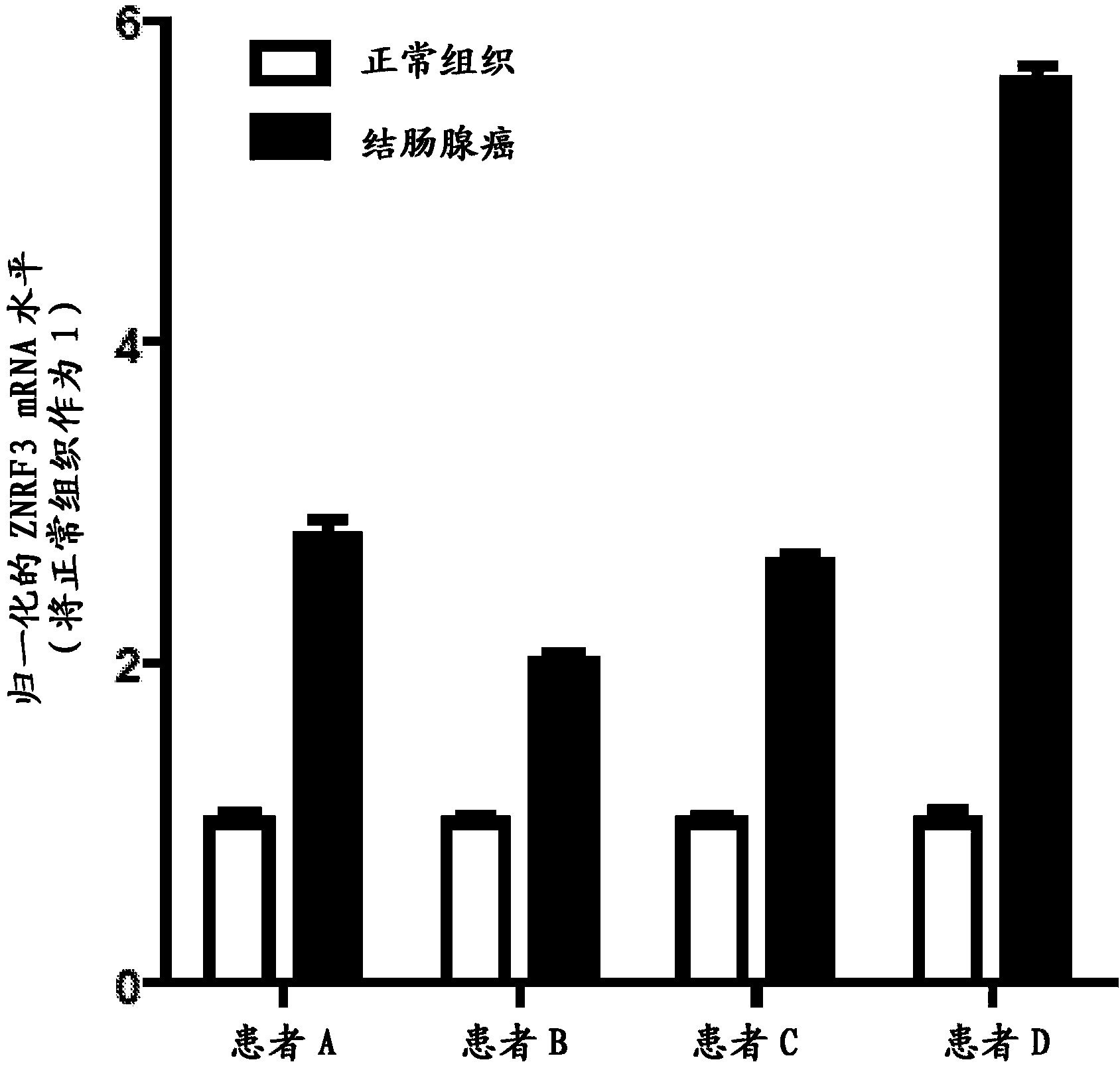 Antibodies and methods for Wnt pathway-related diseases