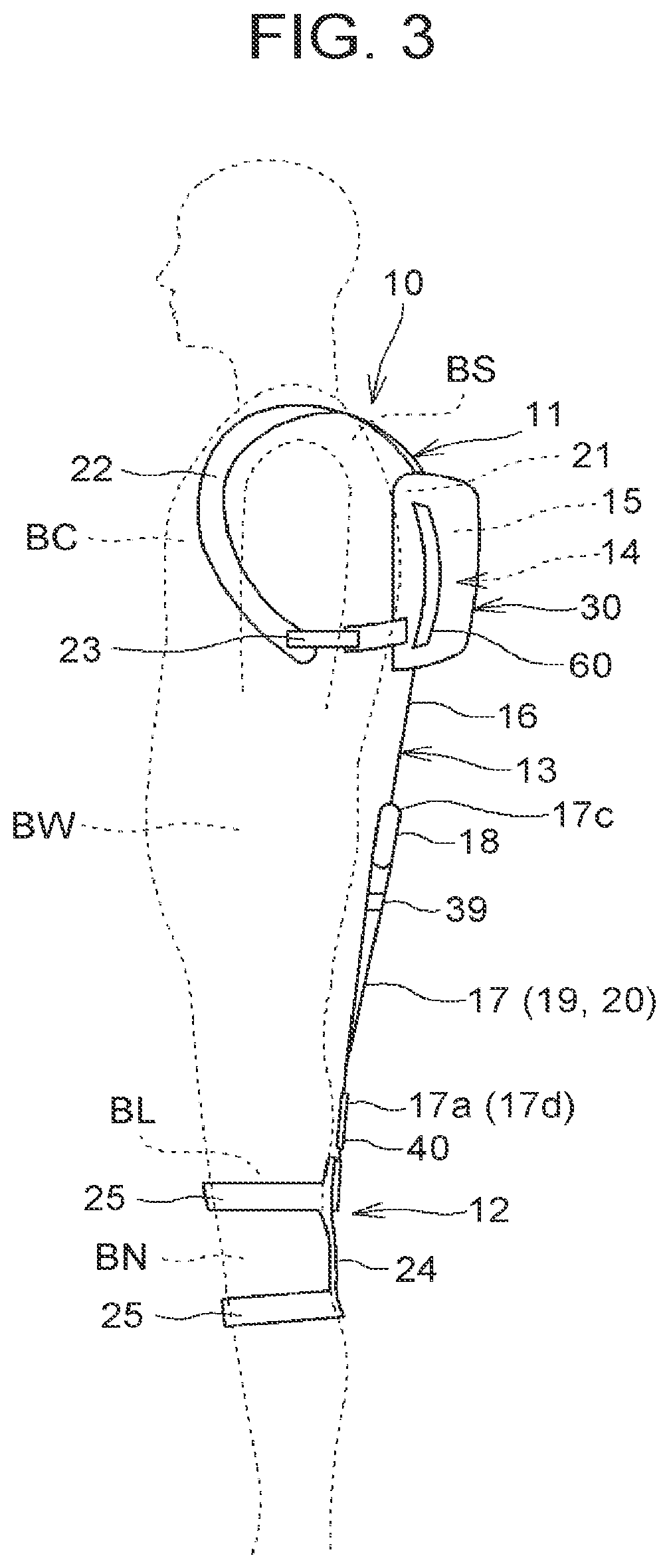 Assist device