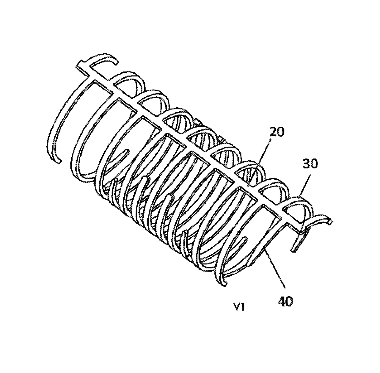 Anti-restenosis coronary stent