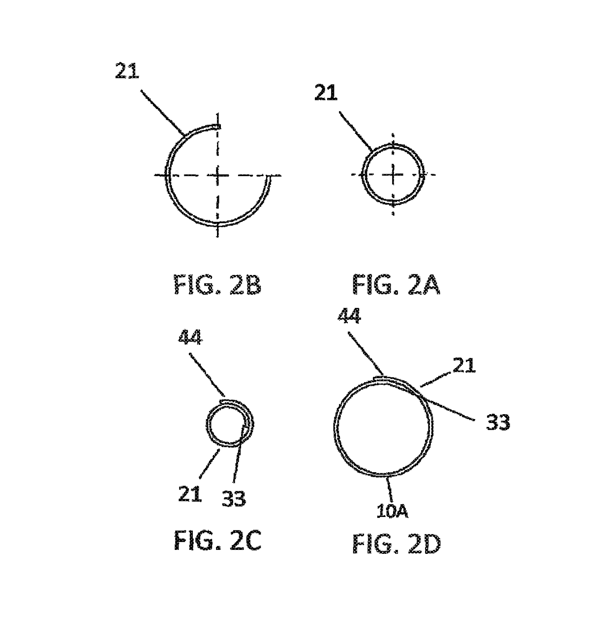 Anti-restenosis coronary stent