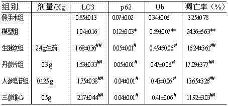 Traditional Chinese medicine composition as well as preparation method and use thereof